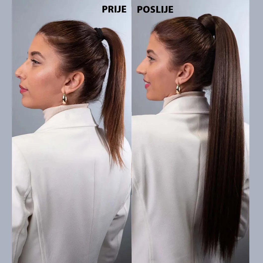 Rep s čičak trakicom – kolekcija